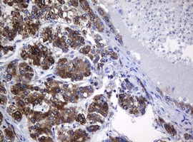 SRPRB Antibody in Immunohistochemistry (Paraffin) (IHC (P))