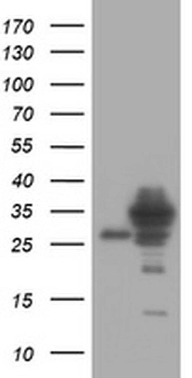 SRPRB Antibody in Western Blot (WB)