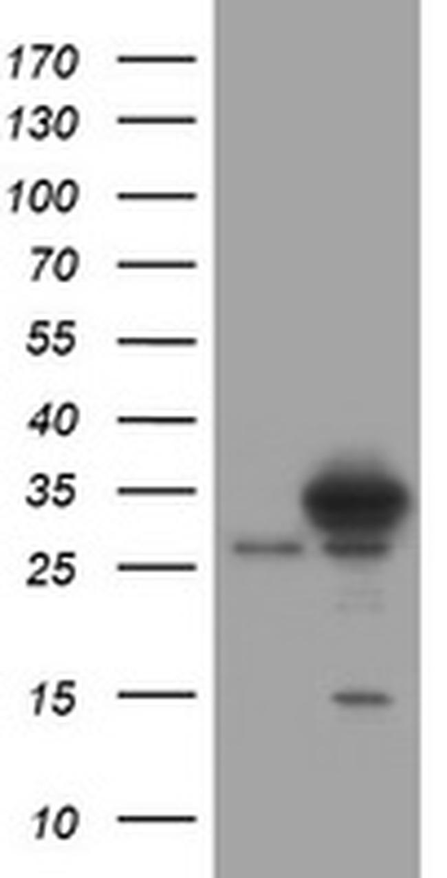 SRPRB Antibody in Western Blot (WB)