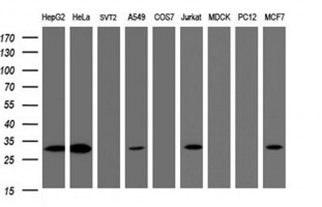 SRPRB Antibody in Western Blot (WB)