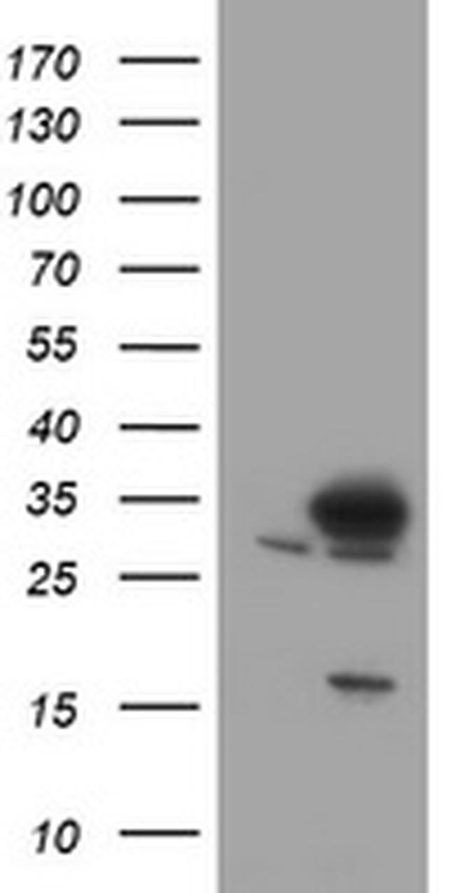 SRPRB Antibody in Western Blot (WB)