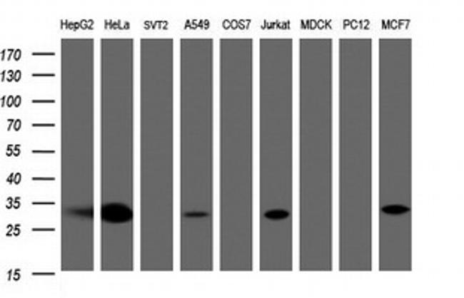 SRPRB Antibody in Western Blot (WB)