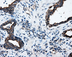 SRR Antibody in Immunohistochemistry (Paraffin) (IHC (P))