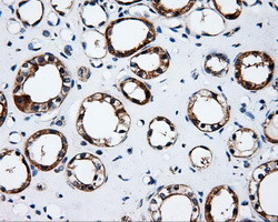 SRR Antibody in Immunohistochemistry (Paraffin) (IHC (P))