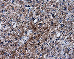 SRR Antibody in Immunohistochemistry (Paraffin) (IHC (P))