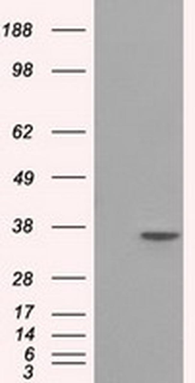 SRR Antibody in Western Blot (WB)