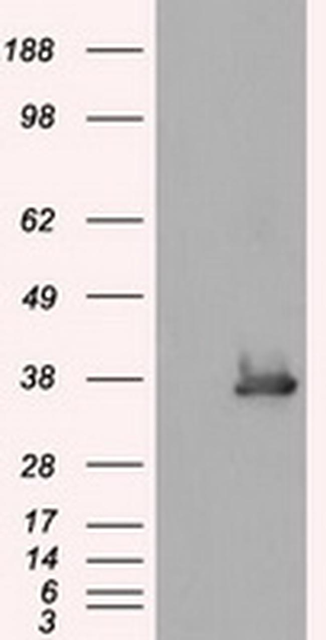 SRR Antibody in Western Blot (WB)