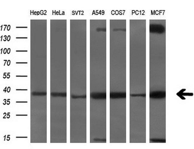 SRR Antibody in Western Blot (WB)