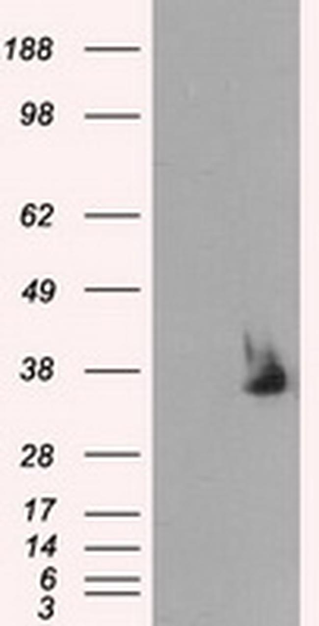 SRR Antibody in Western Blot (WB)