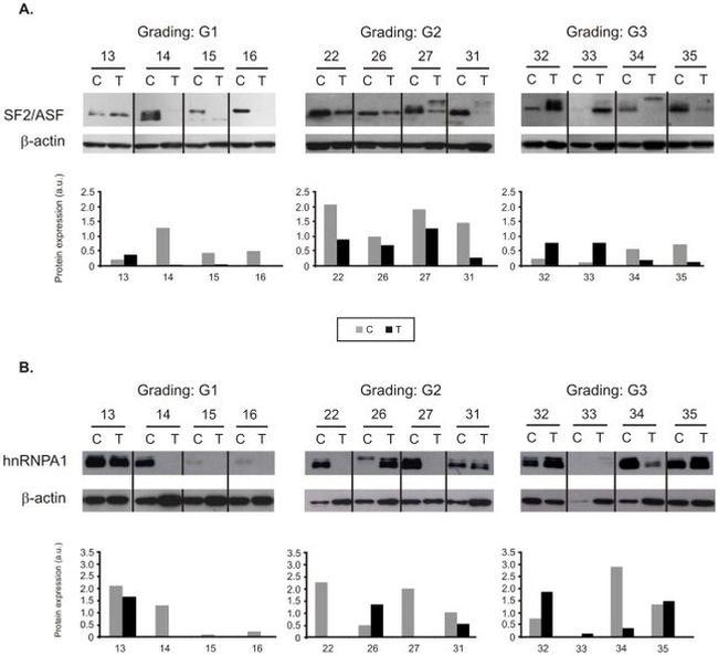 SRSF1 Antibody in Western Blot (WB)