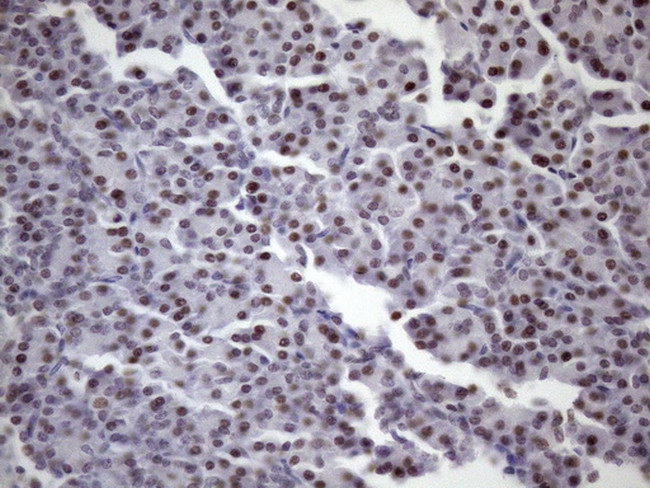 SRSF9 Antibody in Immunohistochemistry (Paraffin) (IHC (P))