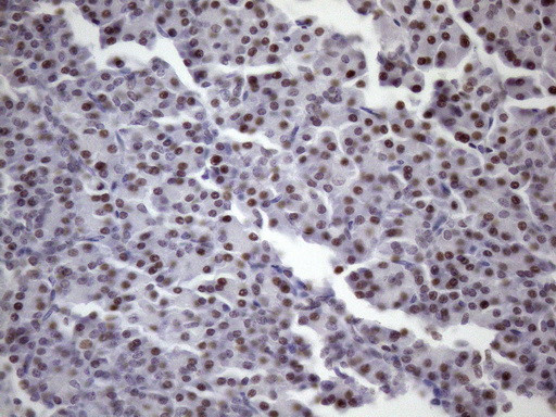 SRSF9 Antibody in Immunohistochemistry (Paraffin) (IHC (P))