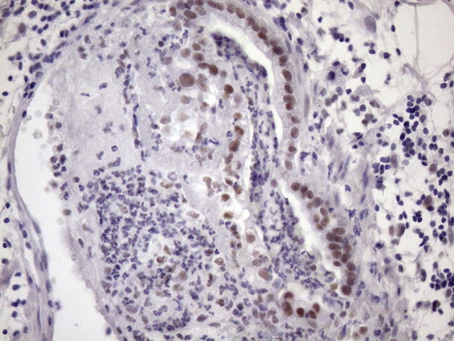 SRSF9 Antibody in Immunohistochemistry (Paraffin) (IHC (P))