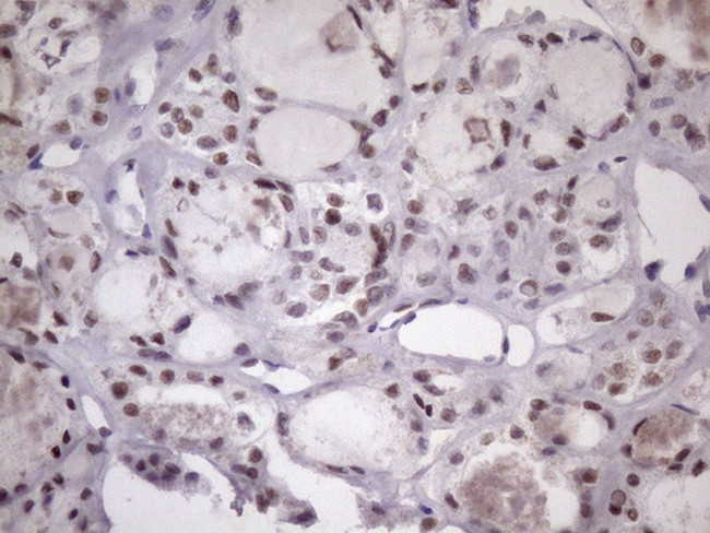 SRSF9 Antibody in Immunohistochemistry (Paraffin) (IHC (P))