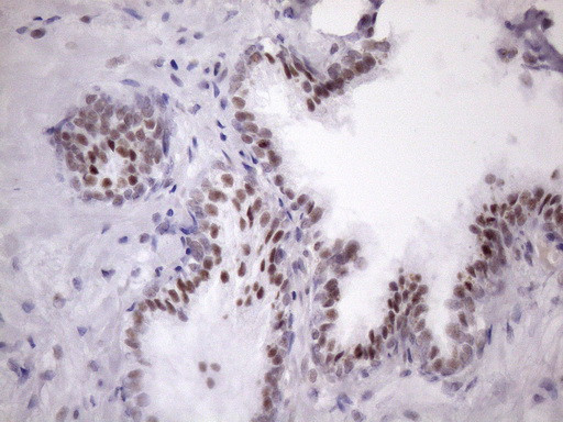 SRSF9 Antibody in Immunohistochemistry (Paraffin) (IHC (P))