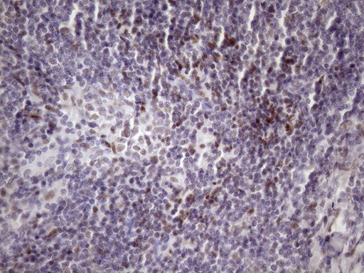 SRSF9 Antibody in Immunohistochemistry (Paraffin) (IHC (P))