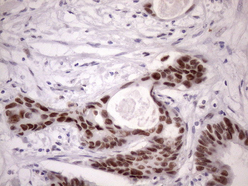 SRSF9 Antibody in Immunohistochemistry (Paraffin) (IHC (P))