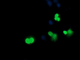 SRY Antibody in Immunocytochemistry (ICC/IF)