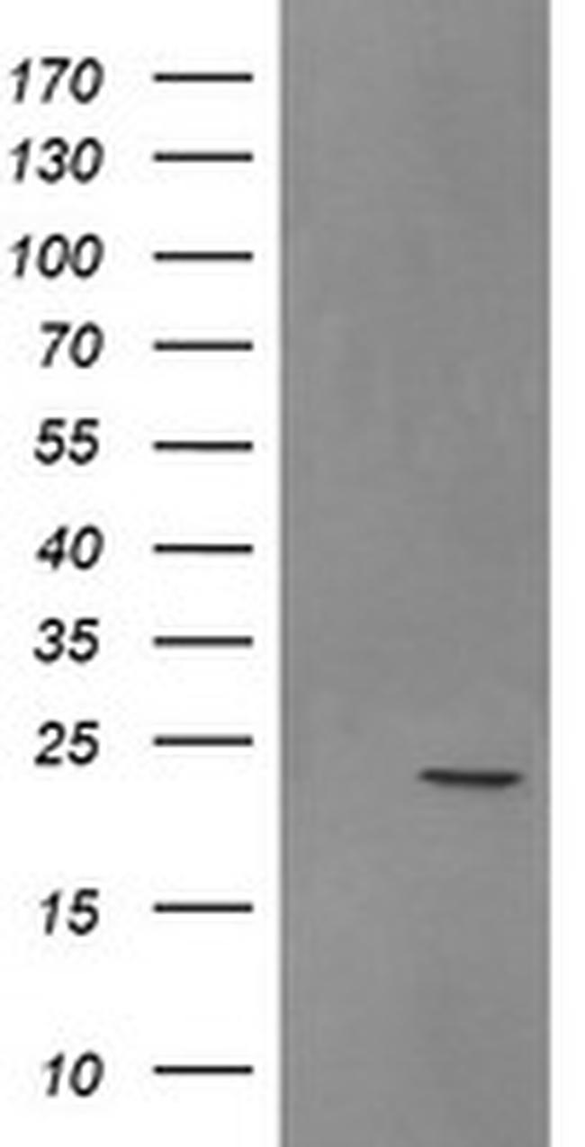 SRY Antibody in Western Blot (WB)