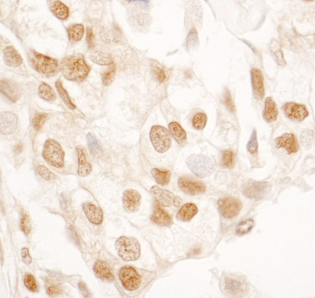 SRcyp Antibody in Immunohistochemistry (IHC)