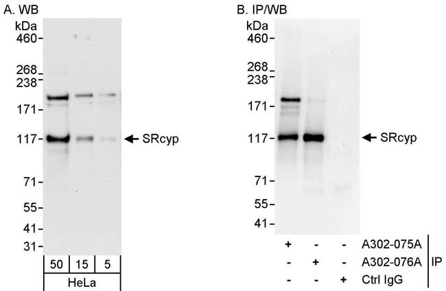 SRcyp Antibody in Western Blot (WB)