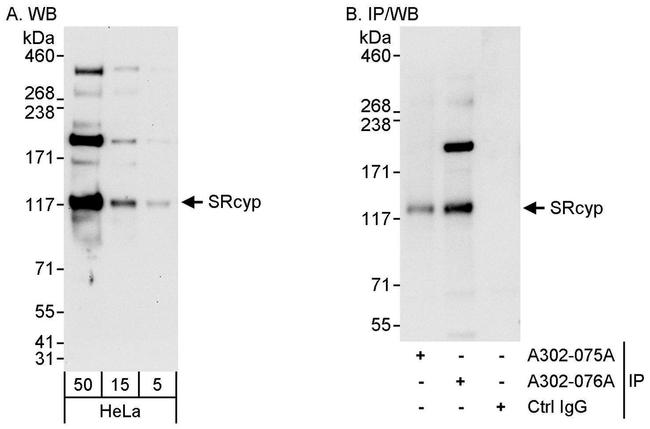 SRcyp Antibody in Western Blot (WB)