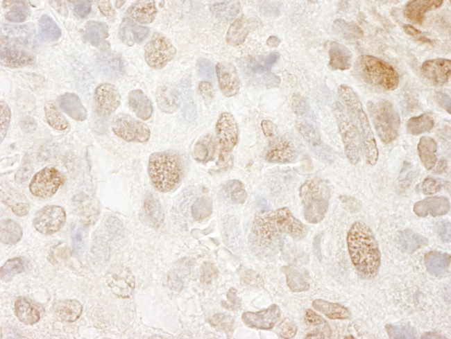 SRcyp Antibody in Immunohistochemistry (IHC)