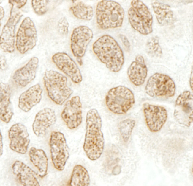 SRcyp Antibody in Immunohistochemistry (IHC)