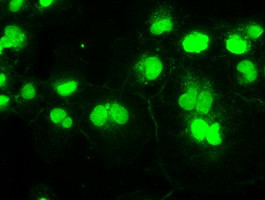 SSB Antibody in Immunocytochemistry (ICC/IF)