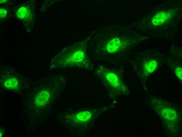 SSB Antibody in Immunocytochemistry (ICC/IF)