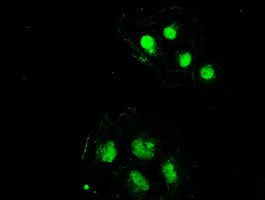 SSB Antibody in Immunocytochemistry (ICC/IF)