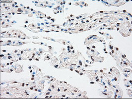 SSB Antibody in Immunohistochemistry (Paraffin) (IHC (P))