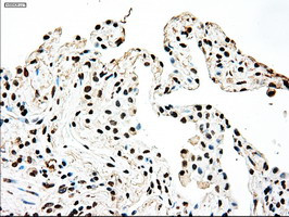 SSB Antibody in Immunohistochemistry (Paraffin) (IHC (P))