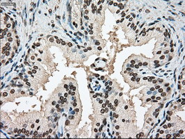 SSB Antibody in Immunohistochemistry (Paraffin) (IHC (P))