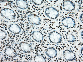 SSB Antibody in Immunohistochemistry (Paraffin) (IHC (P))