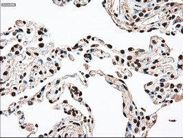 SSB Antibody in Immunohistochemistry (Paraffin) (IHC (P))