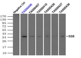 SSB Antibody in Immunoprecipitation (IP)