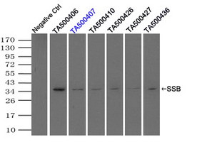 SSB Antibody in Immunoprecipitation (IP)