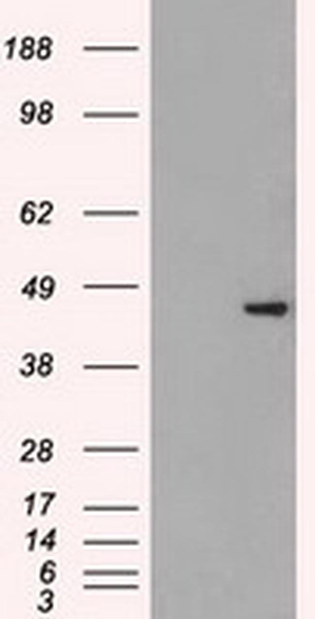 SSB Antibody in Western Blot (WB)