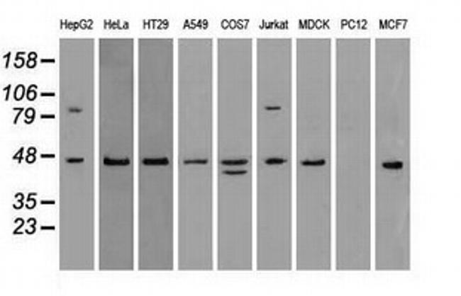 SSB Antibody in Western Blot (WB)