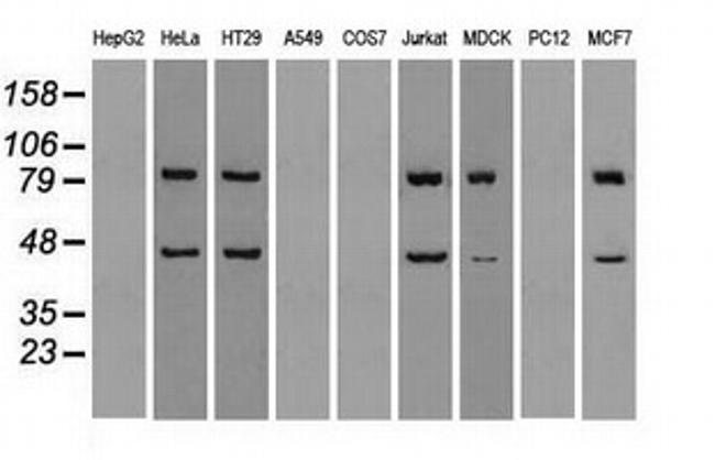 SSB Antibody in Western Blot (WB)