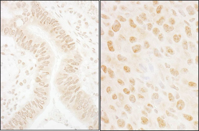 SSB1 Antibody in Immunohistochemistry (IHC)