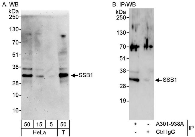 SSB1 Antibody in Western Blot (WB)