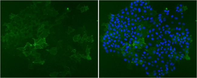 SSEA1 Antibody in Immunocytochemistry (ICC/IF)