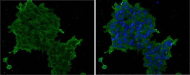 SSEA4 Antibody in Immunocytochemistry (ICC/IF)