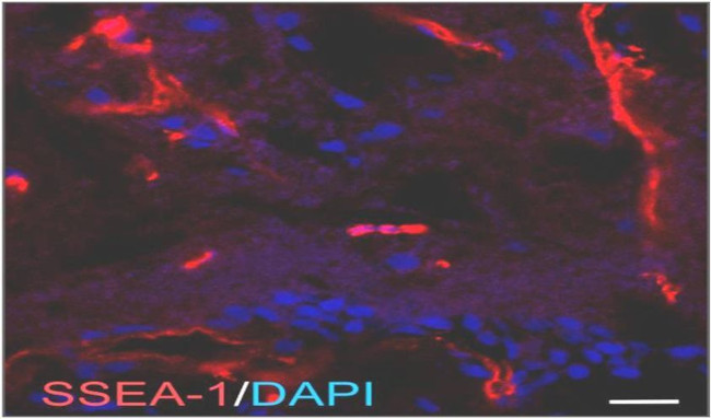 SSEA1 Antibody in Immunohistochemistry (Paraffin) (IHC (P))