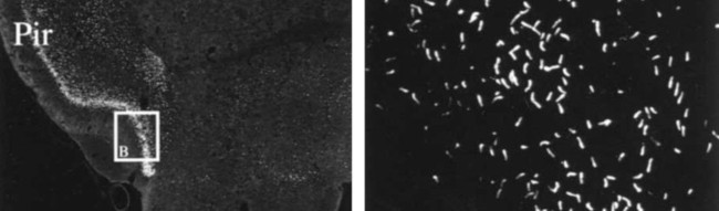 SSTR3 Antibody in Immunohistochemistry (IHC)