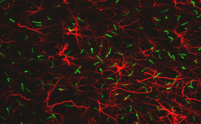 SSTR3 Antibody in Immunocytochemistry (ICC/IF)