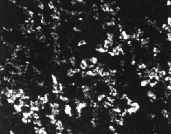 SSTR5 Antibody in Immunocytochemistry (ICC/IF)