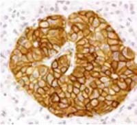 SSTR2 Antibody in Immunohistochemistry (IHC)